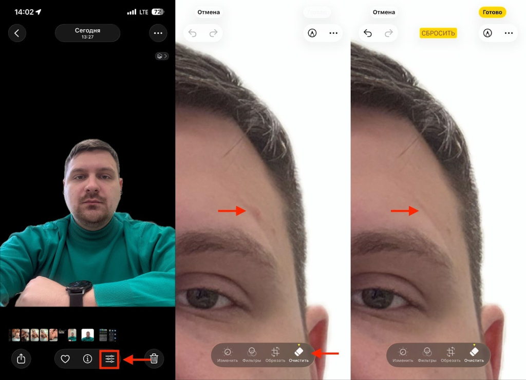 Убрать прыщи на фото Айфона