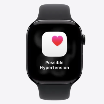 Apple Watch Series 11